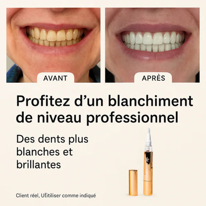 Stylo Blanchissant Express